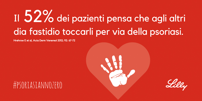 informazioni psoriasi1