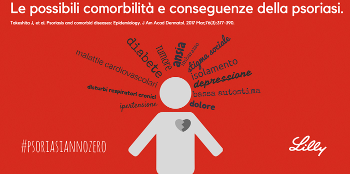 informazioni psoriasi15