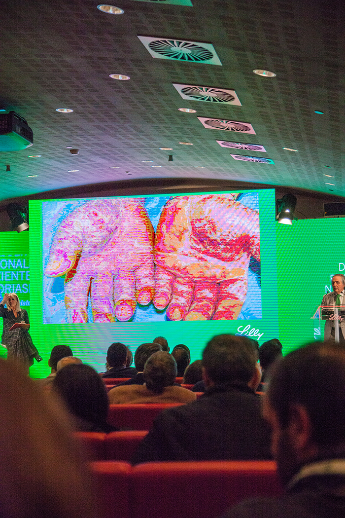 psoriasi lilly sesto fiorentino